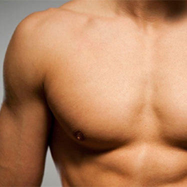 Férfi mellplasztika